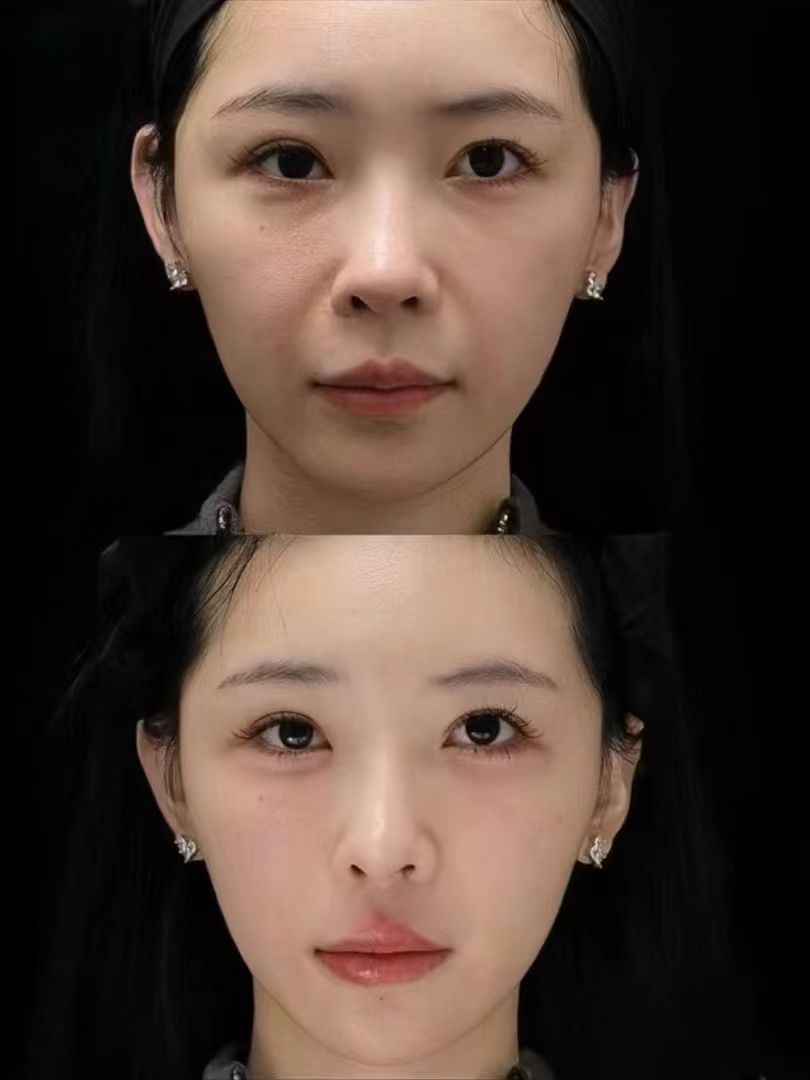 Tạo gương mặt trẻ hoá
